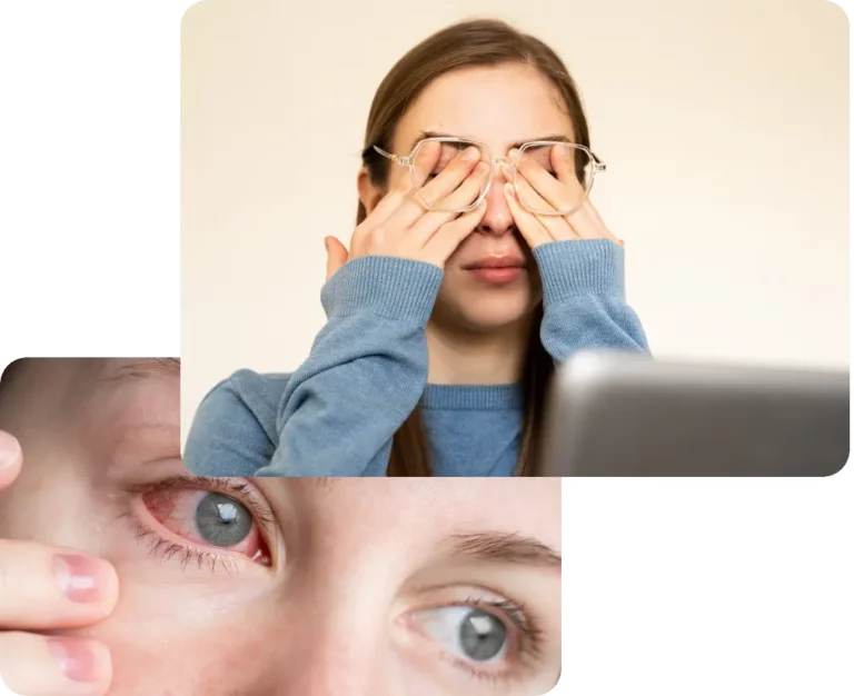zmeczenie-oczu